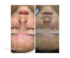 КОСМЕТОЛОГИЯ/ МАССАЖ ЛИЦА/ЛАЗЕРНАЯ ЭПИЛЯЦИЯ: фото 2