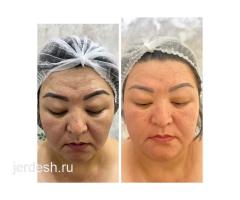 КОСМЕТОЛОГИЯ/ МАССАЖ ЛИЦА/ЛАЗЕРНАЯ ЭПИЛЯЦИЯ: фото 3