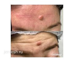 КОСМЕТОЛОГИЯ/ МАССАЖ ЛИЦА/ЛАЗЕРНАЯ ЭПИЛЯЦИЯ: фото 5